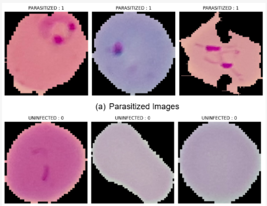 Malaria photo